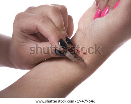 stock-photo-the-girl-cuts-veins-on-a-han