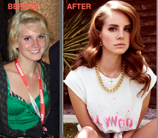 lana_del_rey_plastic-surgery-before-afte